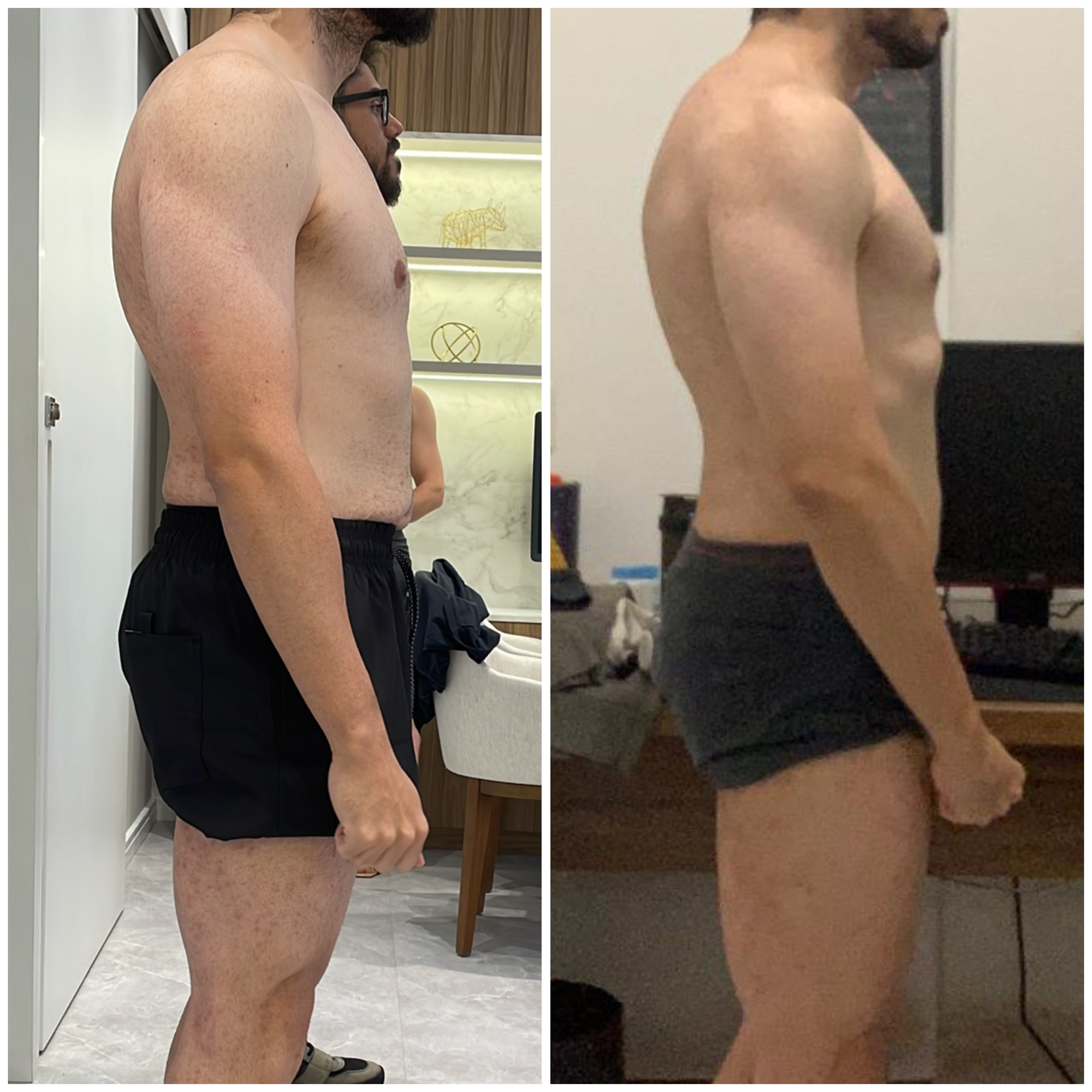 Evolução real de paciente 3